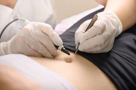 Removal hair from womans legs by electro epilation metod. Cosmetology procedure in beauty cabinet.