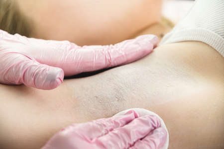Armpit processing and disinfection with powder after electrolysis.の写真素材
