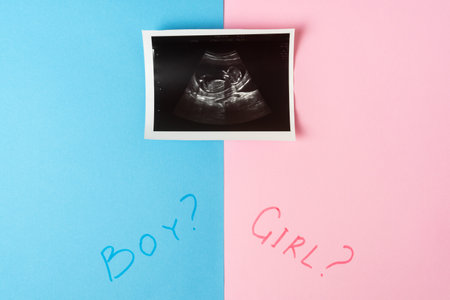 Image of baby in mother womb during ultrasound. Words BOY, GIRL and question mark on pink and blue background.の写真素材