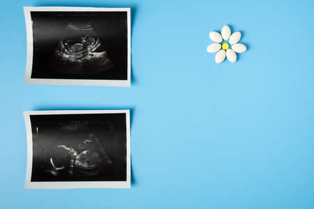 Prenatal vitamins, supplements and medications for healthy pregnancy concept. Image of baby in mother's womb during ultrasound examination and pills of Folic acid and multivitamins on blue background with copy space.の写真素材