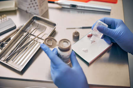 Hands of the dentist doing the filling