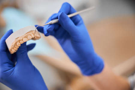 Plaster model of a jaw under dentist inspectionの写真素材
