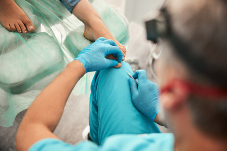 Close up of serious podiatrist treating his patientの写真素材