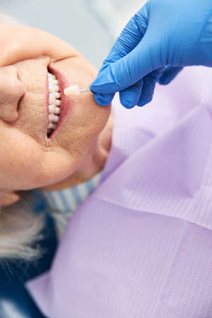 Dentist finding a match to visitor teeth with tooth shade