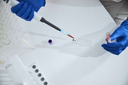 Biochemist using a single-channel pipette for a biochemical analysis