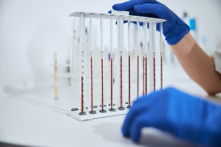 Biochemist examining a set of calibrated pipettes