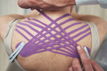 Physiotherapist stabilizing the trapezius muscle with the elastic therapeutic tapeの写真素材