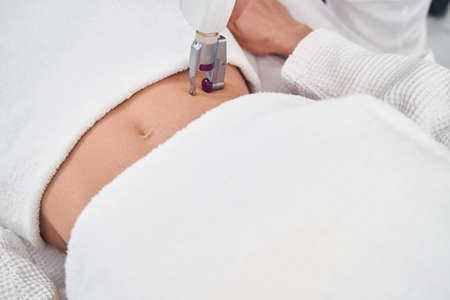 Cosmetologist removing scar on female stomach with equipment