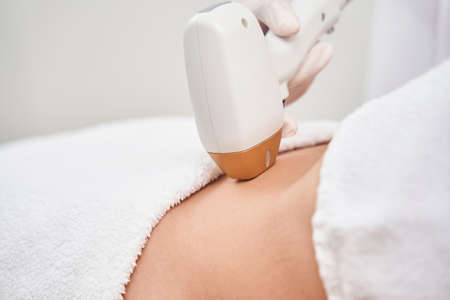 Cosmetologist using laser on female stomach in officeの写真素材