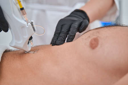 Certified dermatologist carrying out a mesotherapy procedureの写真素材