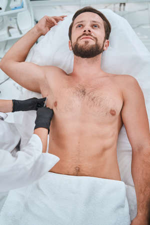 Patient being treated for excessive underarm sweatingの写真素材