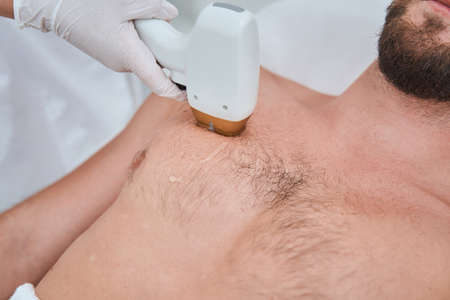 Man undergoing a non-invasive medical procedure done by a cosmetologistの写真素材