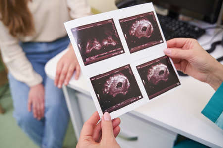 Focused photo on female hands holding ultrasound picture