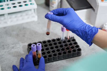 Close-up photo of woman working in laboratory