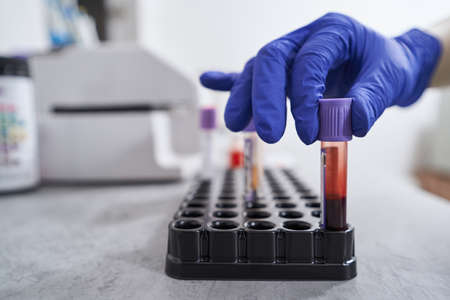 Close-up photo of work in medical laboratory