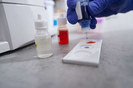 Close-up photo of doctor making test in laboratoryの写真素材