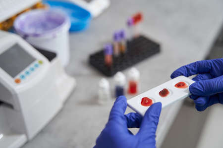Nurse doing medical research in medical laboratory