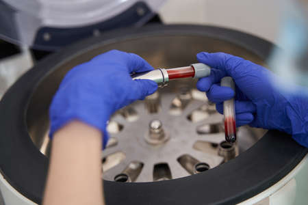Medical worker prepearing for research with centrifuge in hospitalの写真素材
