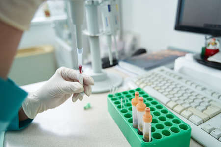 Woman examining chemistry blood tests before computer