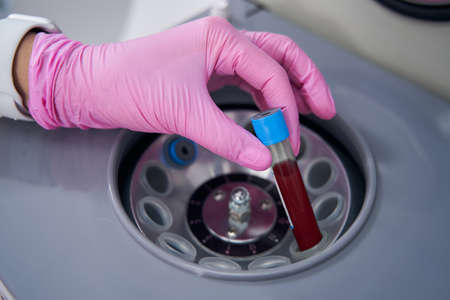 Female hand in medical gloves puts tube into a centrifuge