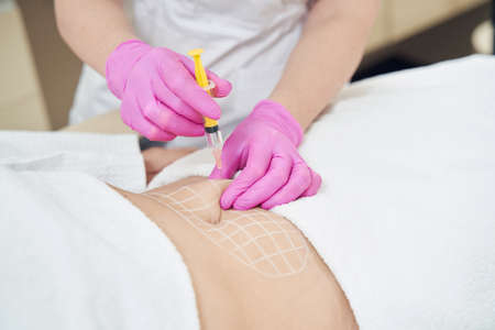 Unrecognized dermatologist is making injection for contouring body in clinicの写真素材