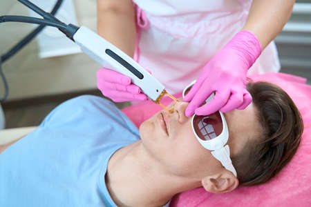 Cosmetologist doing laser epilation for male faceの写真素材