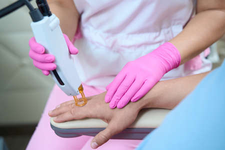 Cosmetologist doing laser epilation for male clientの写真素材