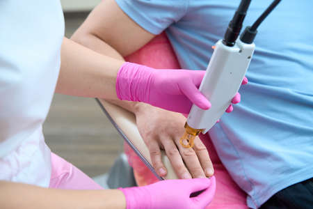 Man visiting cosmetologist for body epilation with equipment