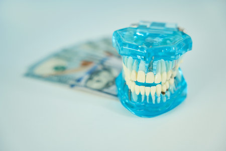 Model of blue human jaw with healthy and damaged teethの写真素材