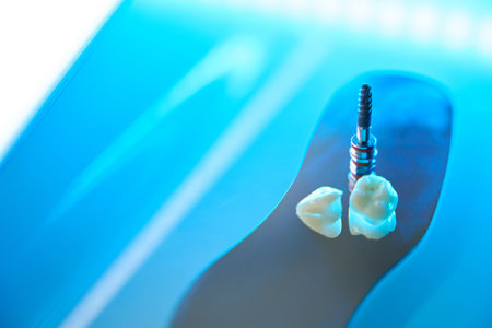 Photo of teeth and dental pin for restoration of toothの写真素材