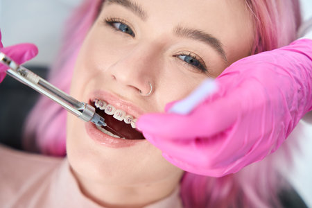 Woman with braces is given injection of anesthesia in gumの写真素材