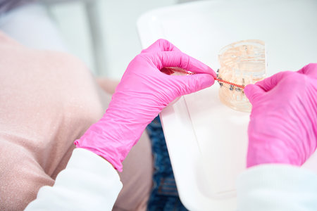 Doctor works with model of dentition with braces and orange consumables