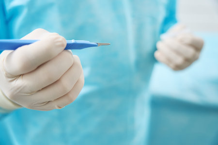 Close up of surgeon holds a scalpel with blue handle in his handの写真素材