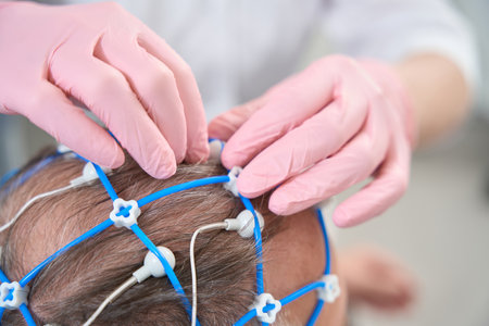 Doctor diagnostician removes electrodes from the head of elderly patient