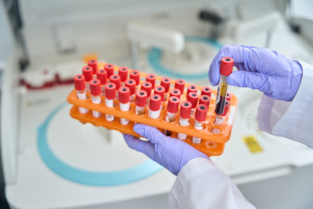 Close up of doctor holding test tubes with blood in medical laboratory