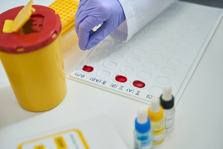 Laboratory assistant works with blood samples on an indication palette