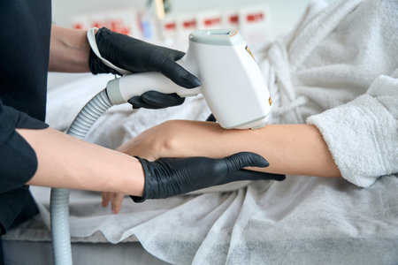 Close up photo of client on laser hair removal courseの写真素材