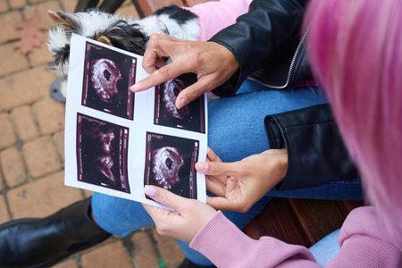 Female showing ultrasound images of unborn baby to female companionの写真素材