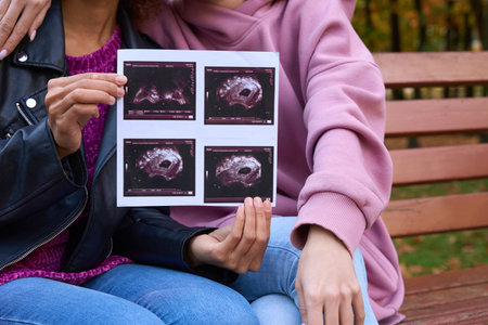 Woman with sonographic images sitting beside her partner in public parkの写真素材
