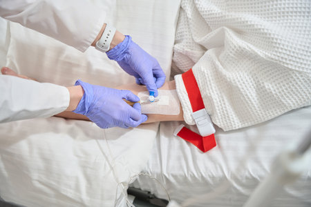 Detail picture of venous catheter in the vein of human hand for blood infusionの写真素材