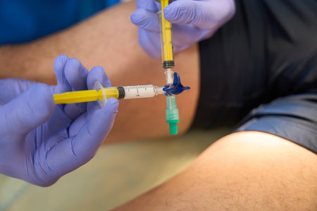 Close-up of injection for the treatment of grid of veins