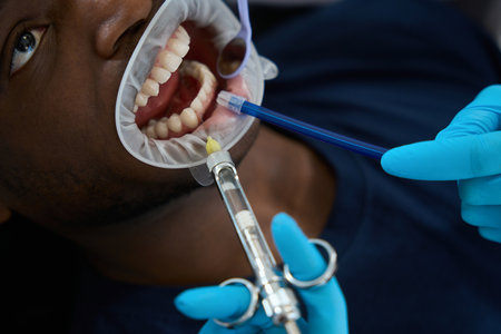 Close-up stomatologist making anaesthetic injection to gum around toothの写真素材