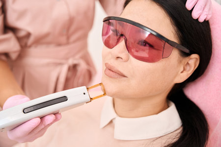 Laser hair removal procedure for chin in a cosmetology clinicの写真素材