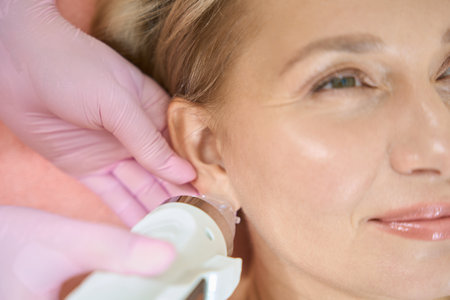 Close up of cosmetologist doing microneedle rf lifting of ear skin of womanの写真素材