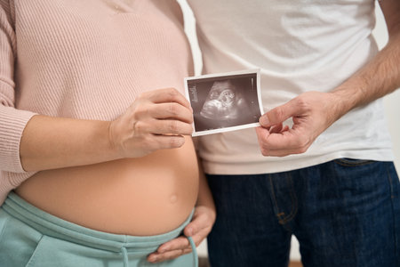 Husband and wife hugging holding ultrasound image of babyの写真素材