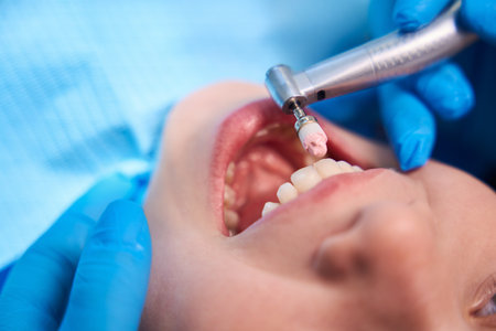 Procedure for polishing the teeth of a teenage girlの写真素材