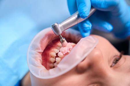 Dentist removes plaque from a teenage girlの写真素材