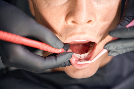 Dentist exploring pockets between teeth of client using curette and mirror