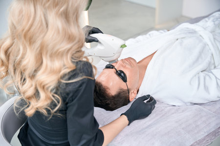 Female beautician doing laser hair removal procedure on male faceの写真素材