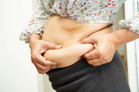 Overweight asian woman use hand to squeeze fat belly big size overweight and obesity.の写真素材